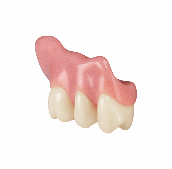 Prothesensattel