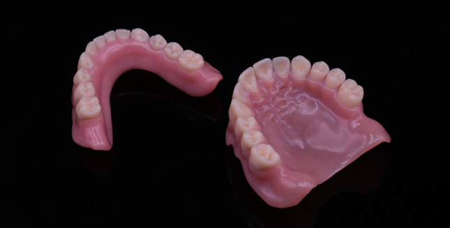 3D-gedruckte Totalprothesen für Ober- und Unterkiefer aus TrueDent – Fallbericht NOVOPRINT